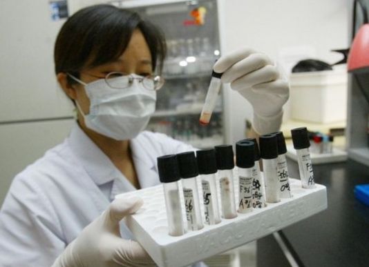 苏州怀孕30天可以做怀孕亲子鉴定吗